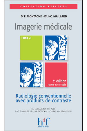 IMAGERIE MEDICALE. TOME 2, RADIOLOGIE CONVENTIONNELLE AVEC PRODUITS DE CONTRASTE. 3è édition corrigée